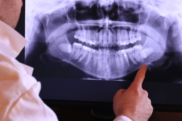 Best Root Canal Emergency Dentist  in Chalmette, LA